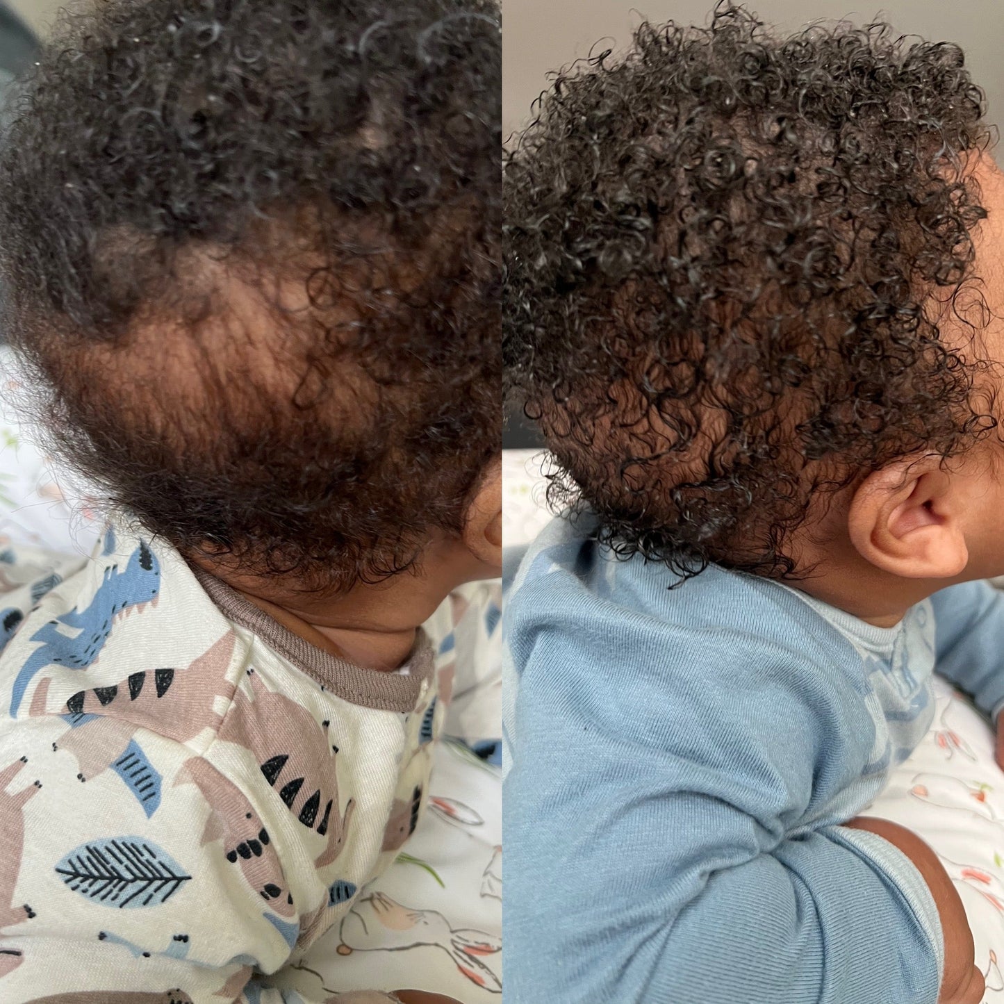 Baby Hair & Scalp Oil